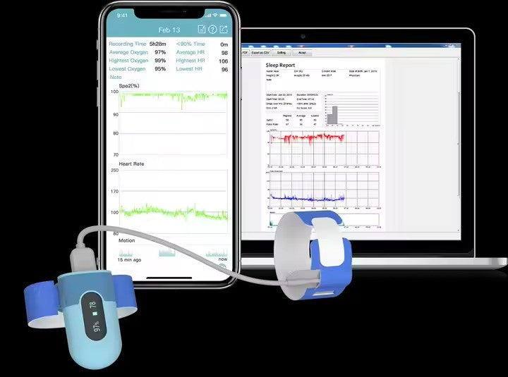 Baby O2 Mart Sock Infant Pulse Oximeter